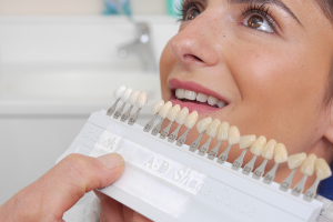 tooth whitening in Bradford - step 4