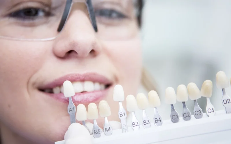woman at a dentist in bradford viewing tooth whitening kits.